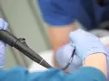 Lekarz w rękawiczkach przygotowuje się do gastroskopii. Czy gastroskopia boli? Znieczulenie i profesjonalizm lekarza minimalizują dyskomfort.
