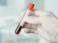 Ręka w białej rękawiczce trzyma probówkę z krwią. Na etykiecie widnieją oznaczenia t3 i t4, wskazujące na analizę parametrów.