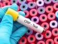 Rękawiczka w niebieskiej rękawiczce trzyma probówkę z napisem "CRP - Test" na tle wielu kolorowych probówek.