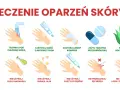 Co na oparzenia dla dziecka: chłodna woda, maść z antybiotykiem, zimny kompres, tabletki przeciwbólowe, sok z aloesu. Unikaj masła, jajka, pasty do zębów, lodu.