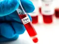 Ręka w niebieskiej rękawiczce trzyma probówkę z krwią oznaczoną "Tsh". W tle inne probówki. Badanie TSH pomaga diagnozować niedoczynność tarczycy.