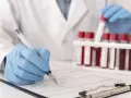 Laborant w rękawiczkach zapisuje dane pacjenta, obok stoją probówki z krwią do analizy CRP.