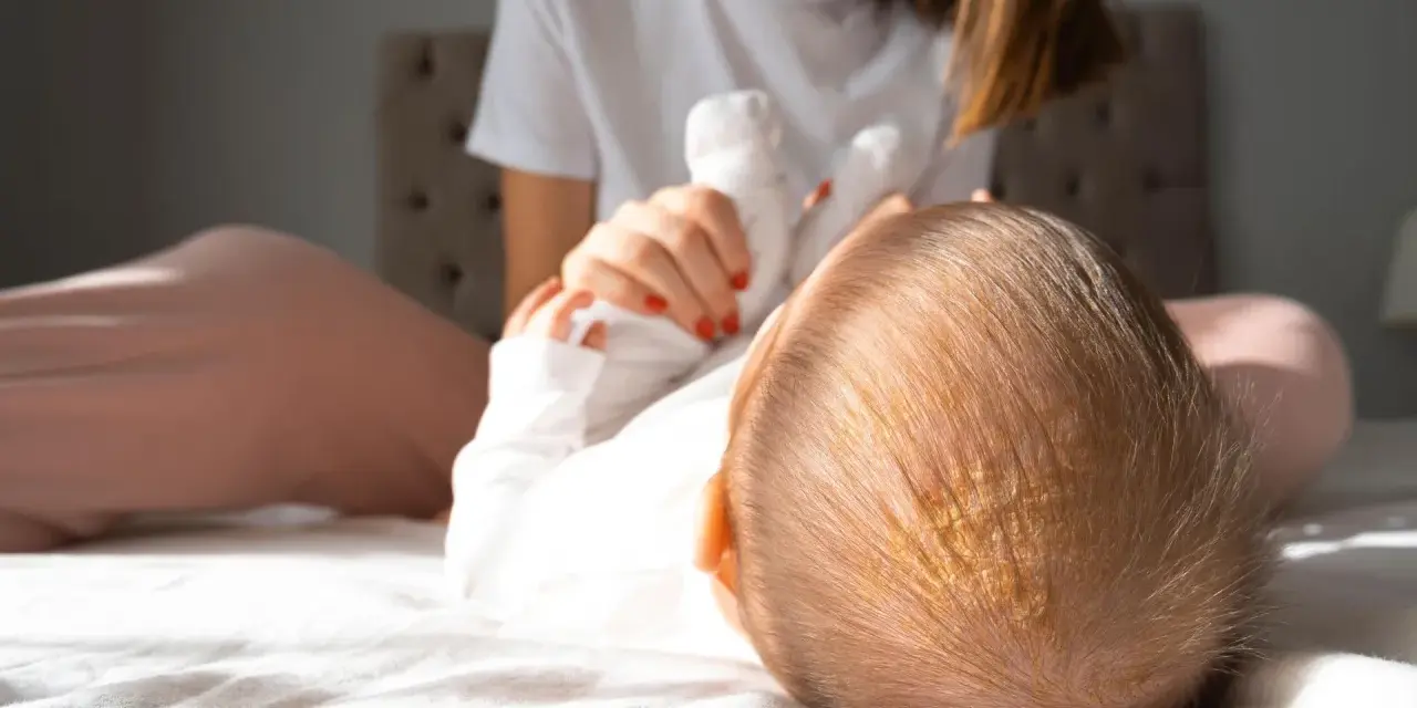 Ciemieniucha co to? Widok z góry na główkę niemowlaka z żółtawymi łuskami. Mama w tle.