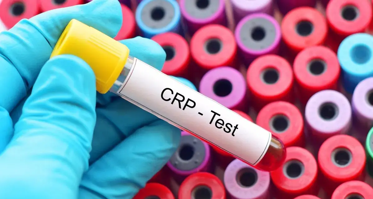 Rękawiczka w niebieskiej rękawiczce trzyma probówkę z napisem "CRP - Test" na tle wielu kolorowych probówek.