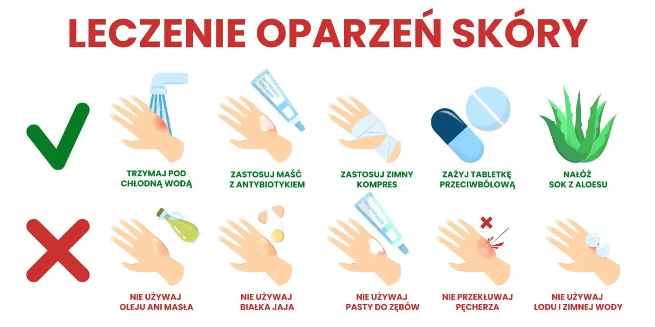 Co na oparzenia dla dziecka: chłodna woda, maść z antybiotykiem, zimny kompres, tabletki przeciwbólowe, sok z aloesu. Unikaj masła, jajka, pasty do zębów, lodu.