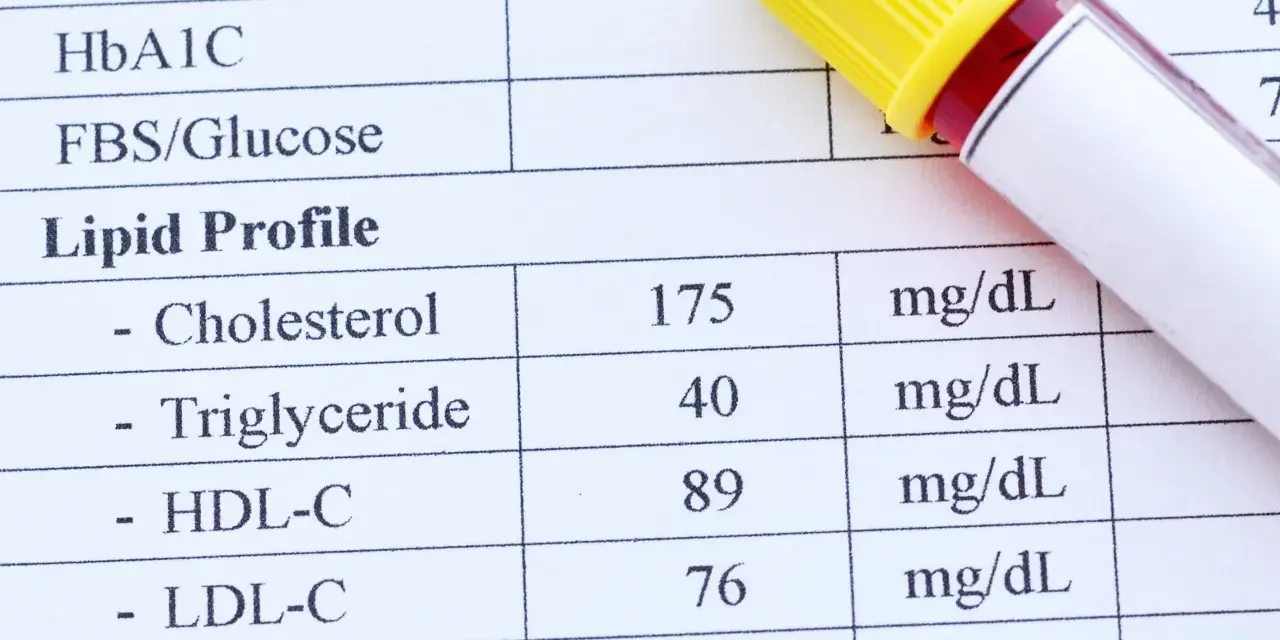 Wyniki badań lipidogram: cholesterol, trójglicerydy, HDL-C, LDL-C. Obok probówka z krwią.