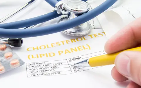 Wynik badania cholesterolu, stetoskop i tabletki. Dowiedz się, jak zbadać cholesterol.