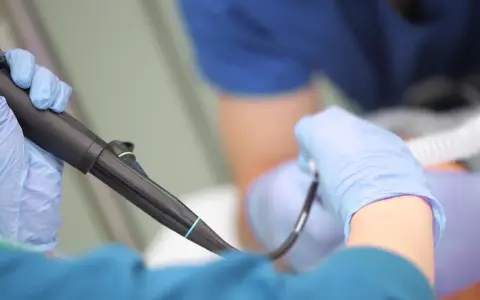 Lekarz w rękawiczkach przygotowuje się do gastroskopii. Czy gastroskopia boli? Znieczulenie i profesjonalizm lekarza minimalizują dyskomfort.