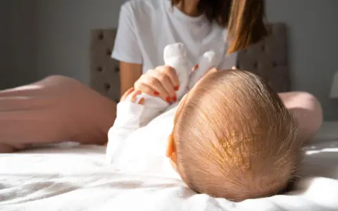 Ciemieniucha co to? Widok z góry na główkę niemowlaka z żółtawymi łuskami. Mama w tle.