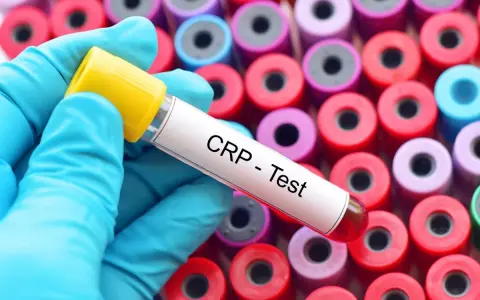 Rękawiczka w niebieskiej rękawiczce trzyma probówkę z napisem "CRP - Test" na tle wielu kolorowych probówek.