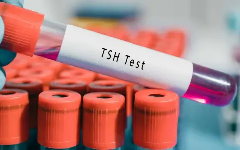 Ręka w niebieskiej rękawiczce trzyma probówkę z napisem "TSH Test". W tle widać rząd innych probówek z pomarańczowymi nakrętkami. Wynik TSH powyżej 100 może wskazywać na niedoczynność tarczycy.