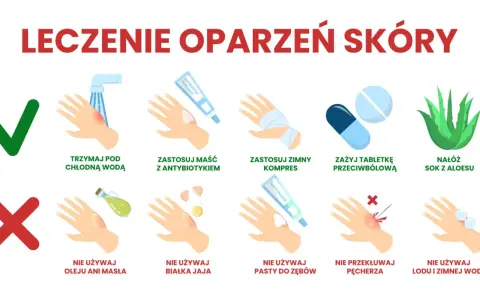 Co na oparzenia dla dziecka: chłodna woda, maść z antybiotykiem, zimny kompres, tabletki przeciwbólowe, sok z aloesu. Unikaj masła, jajka, pasty do zębów, lodu.