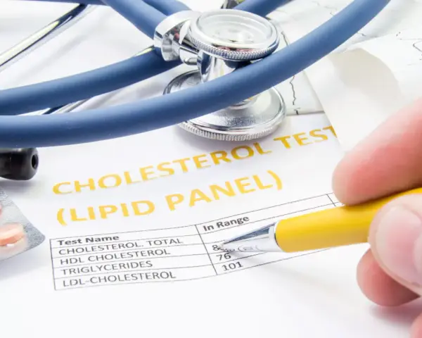 Wynik badania cholesterolu, stetoskop i tabletki. Dowiedz się, jak zbadać cholesterol.