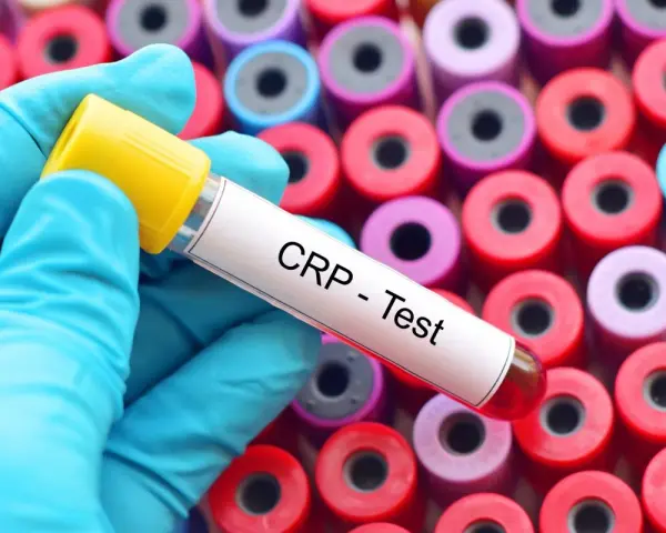 Rękawiczka w niebieskiej rękawiczce trzyma probówkę z napisem "CRP - Test" na tle wielu kolorowych probówek.