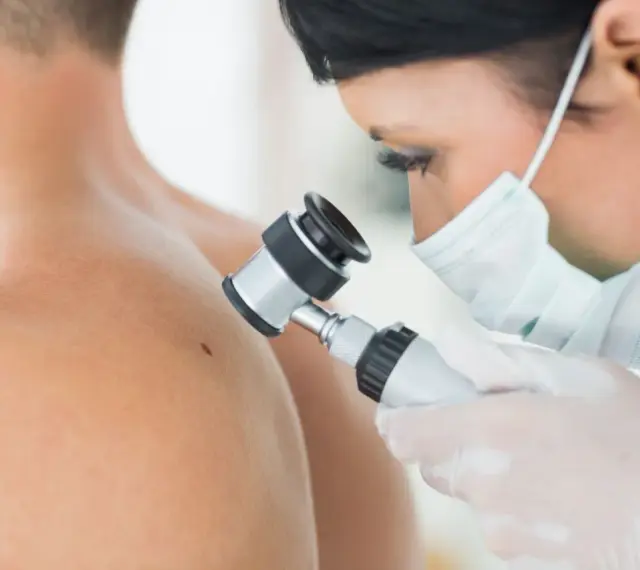 Lekarz w masce i rękawiczkach bada pieprzyk dermatoskopem. To właśnie dermatoskopia co to jest, czyli badanie skóry pod powiększeniem.
