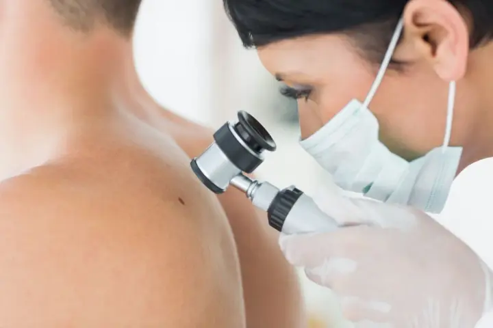 Lekarz w masce i rękawiczkach bada pieprzyk dermatoskopem. To właśnie dermatoskopia co to jest, czyli badanie skóry pod powiększeniem.