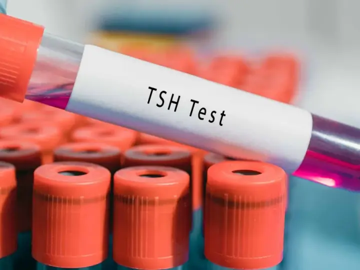 Ręka w niebieskiej rękawiczce trzyma probówkę z napisem "TSH Test". W tle widać rząd innych probówek z pomarańczowymi nakrętkami. Wynik TSH powyżej 100 może wskazywać na niedoczynność tarczycy.