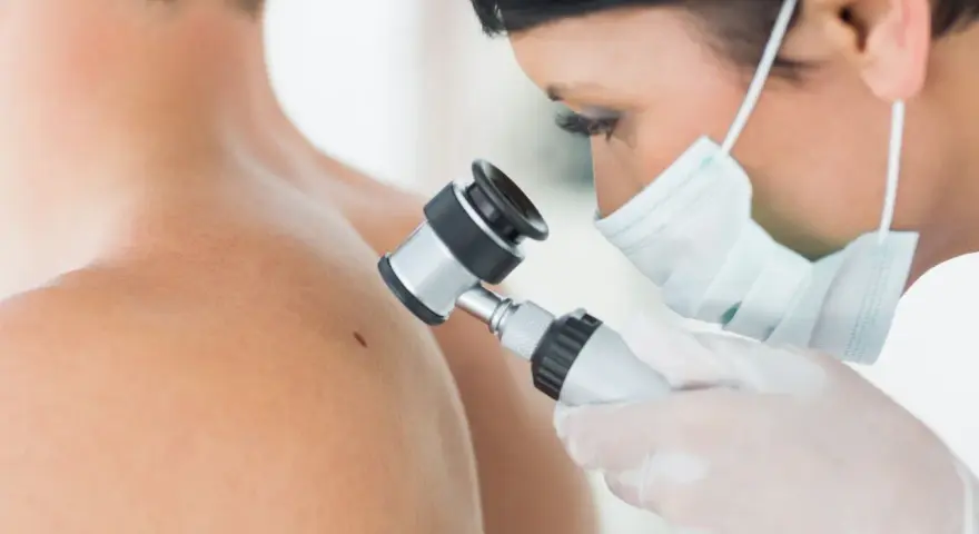 Lekarz w masce i rękawiczkach bada pieprzyk dermatoskopem. To właśnie dermatoskopia co to jest, czyli badanie skóry pod powiększeniem.