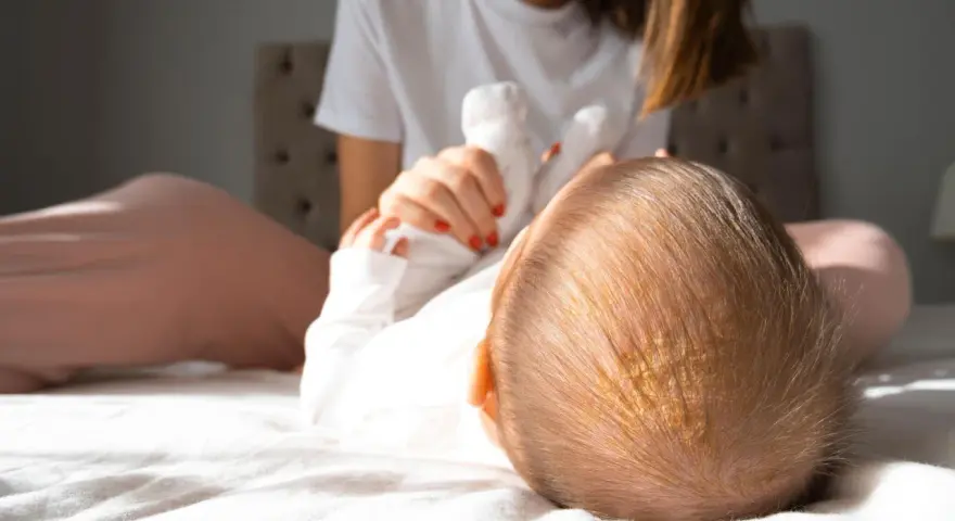 Ciemieniucha co to? Widok z góry na główkę niemowlaka z żółtawymi łuskami. Mama w tle.