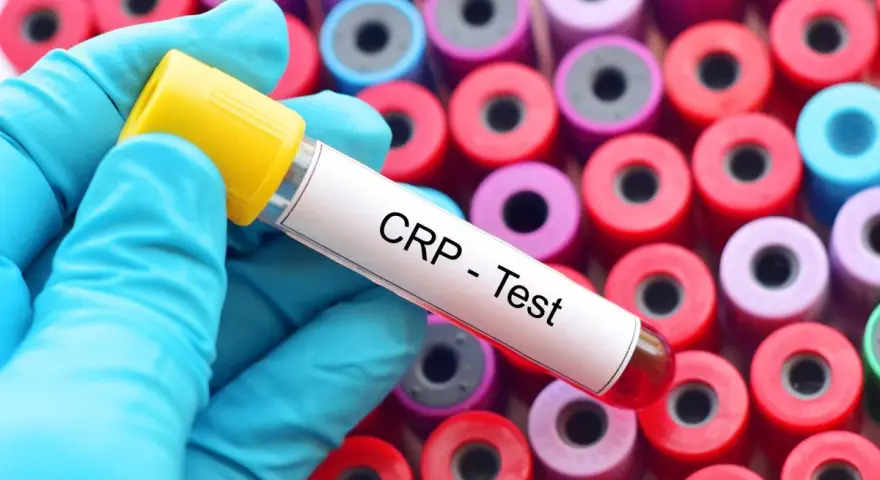 Rękawiczka w niebieskiej rękawiczce trzyma probówkę z napisem "CRP - Test" na tle wielu kolorowych probówek.