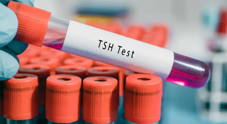 Ręka w niebieskiej rękawiczce trzyma probówkę z napisem "TSH Test". W tle widać rząd innych probówek z pomarańczowymi nakrętkami. Wynik TSH powyżej 100 może wskazywać na niedoczynność tarczycy.