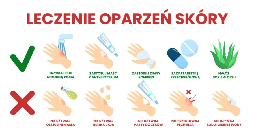 Co na oparzenia dla dziecka: chłodna woda, maść z antybiotykiem, zimny kompres, tabletki przeciwbólowe, sok z aloesu. Unikaj masła, jajka, pasty do zębów, lodu.