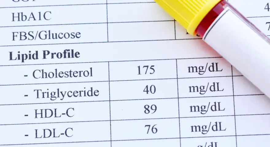 Wyniki badań lipidogram: cholesterol, trójglicerydy, HDL-C, LDL-C. Obok probówka z krwią.