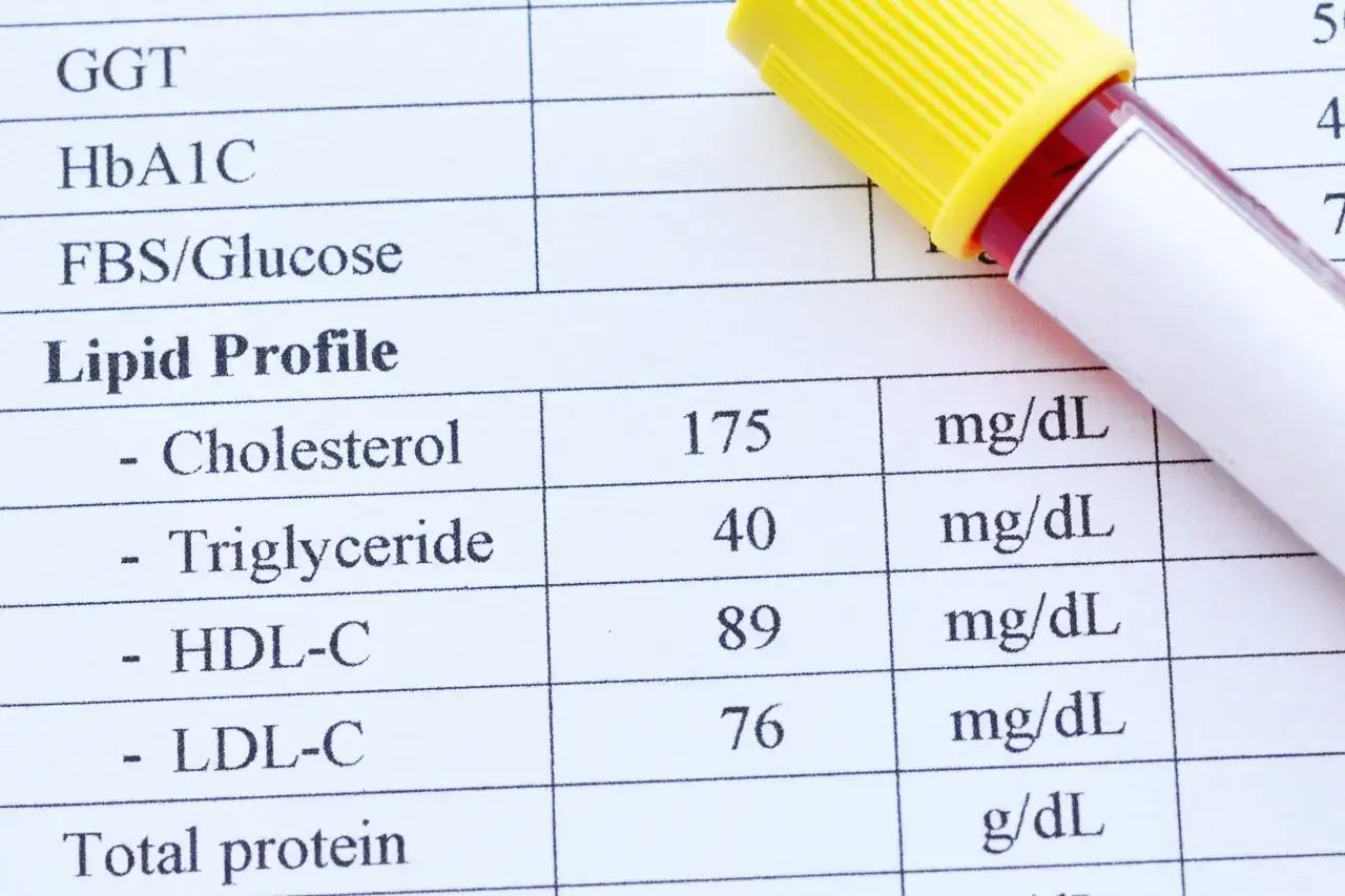 Wyniki badań lipidogram jakie badania: cholesterol, triglicerydy, HDL-C, LDL-C. Obok prob&oacute;wka z krwią.