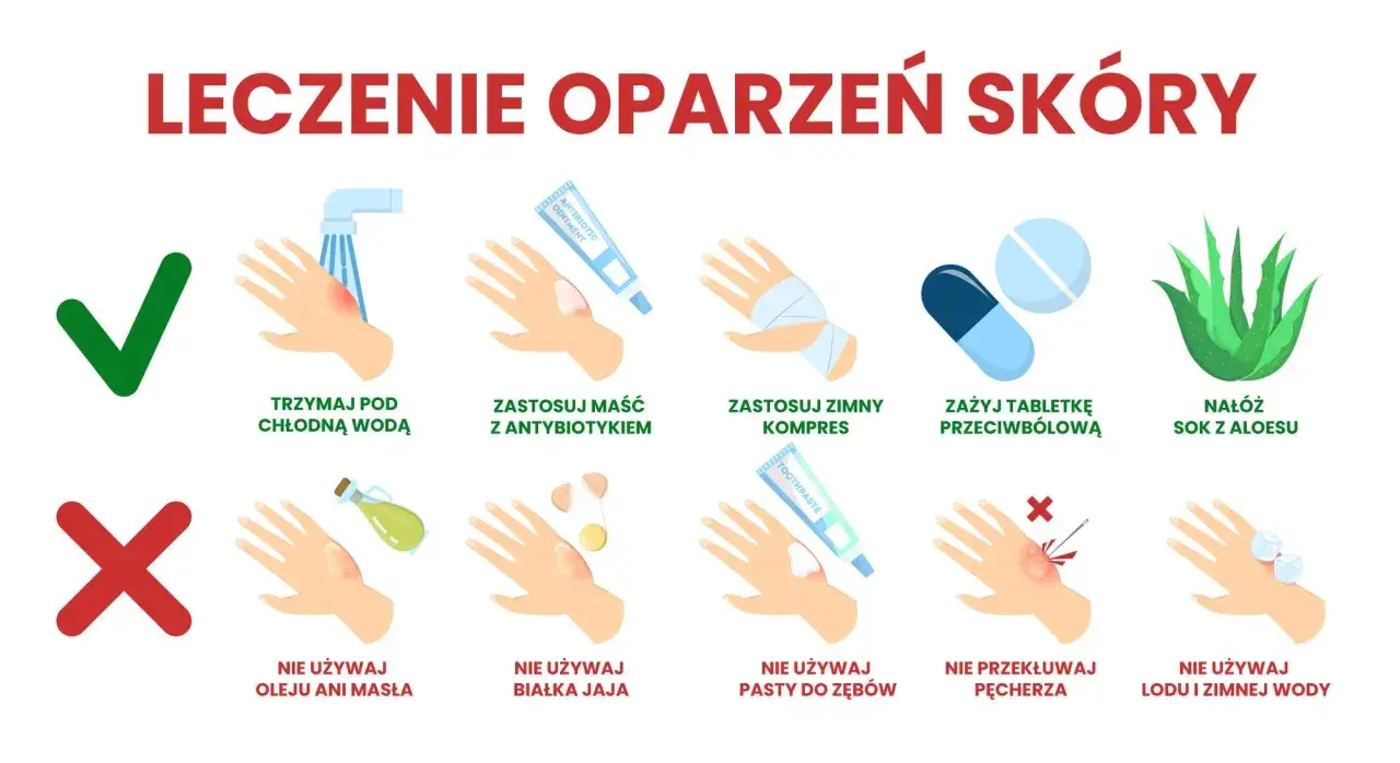 Co na oparzenia dla dziecka: chłodna woda, maść z antybiotykiem, zimny kompres, tabletki przeciwbólowe, sok z aloesu. Unikaj masła, jajka, pasty do zębów, lodu.