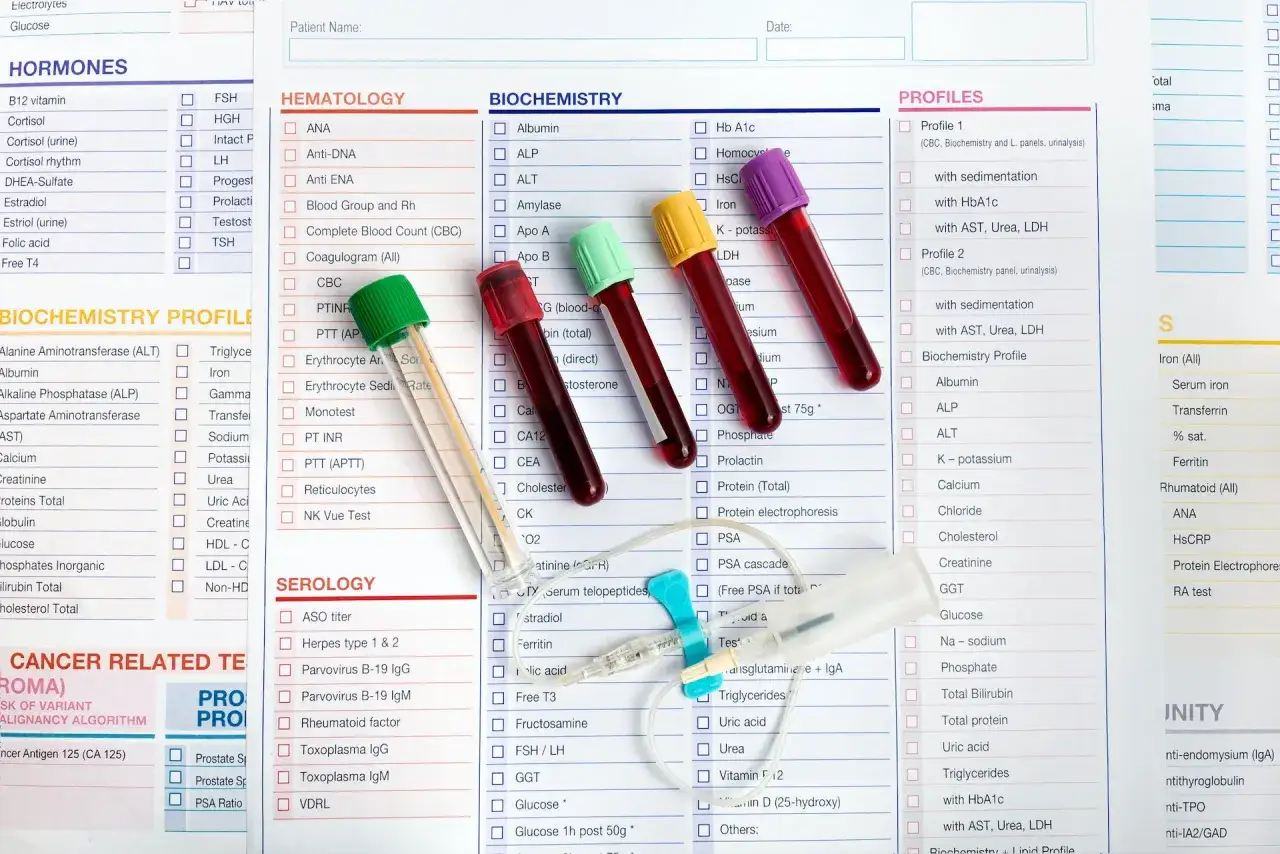 Badanie morfologia co to? Lista badań biochemicznych, hematologicznych i serologicznych z próbkami krwi.