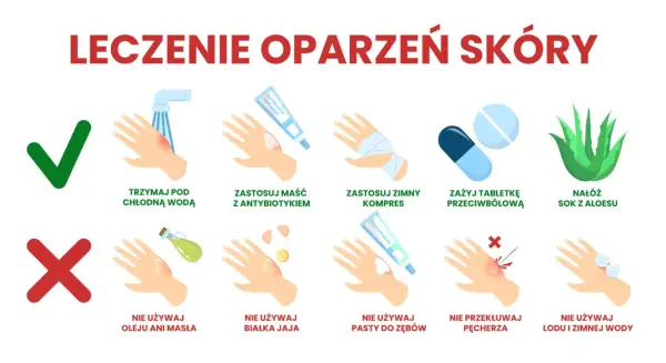 Co na oparzenia dla dziecka: chłodna woda, maść z antybiotykiem, zimny kompres, tabletki przeciwbólowe, sok z aloesu. Unikaj masła, jajka, pasty do zębów, lodu.